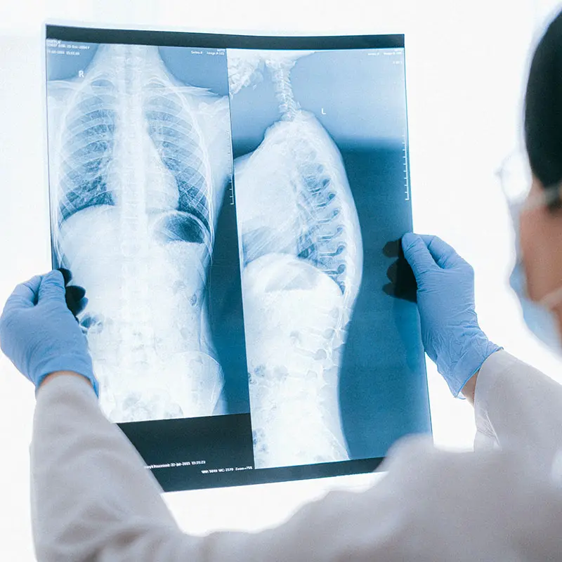 Doctor Holding an X-ray Result